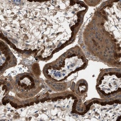 TPK1 Antibody, Novus Biologicals 25 &mu;L; Unlabeled:Antibodies, Polyclonal